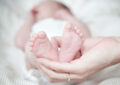 common birth injuries in newborns